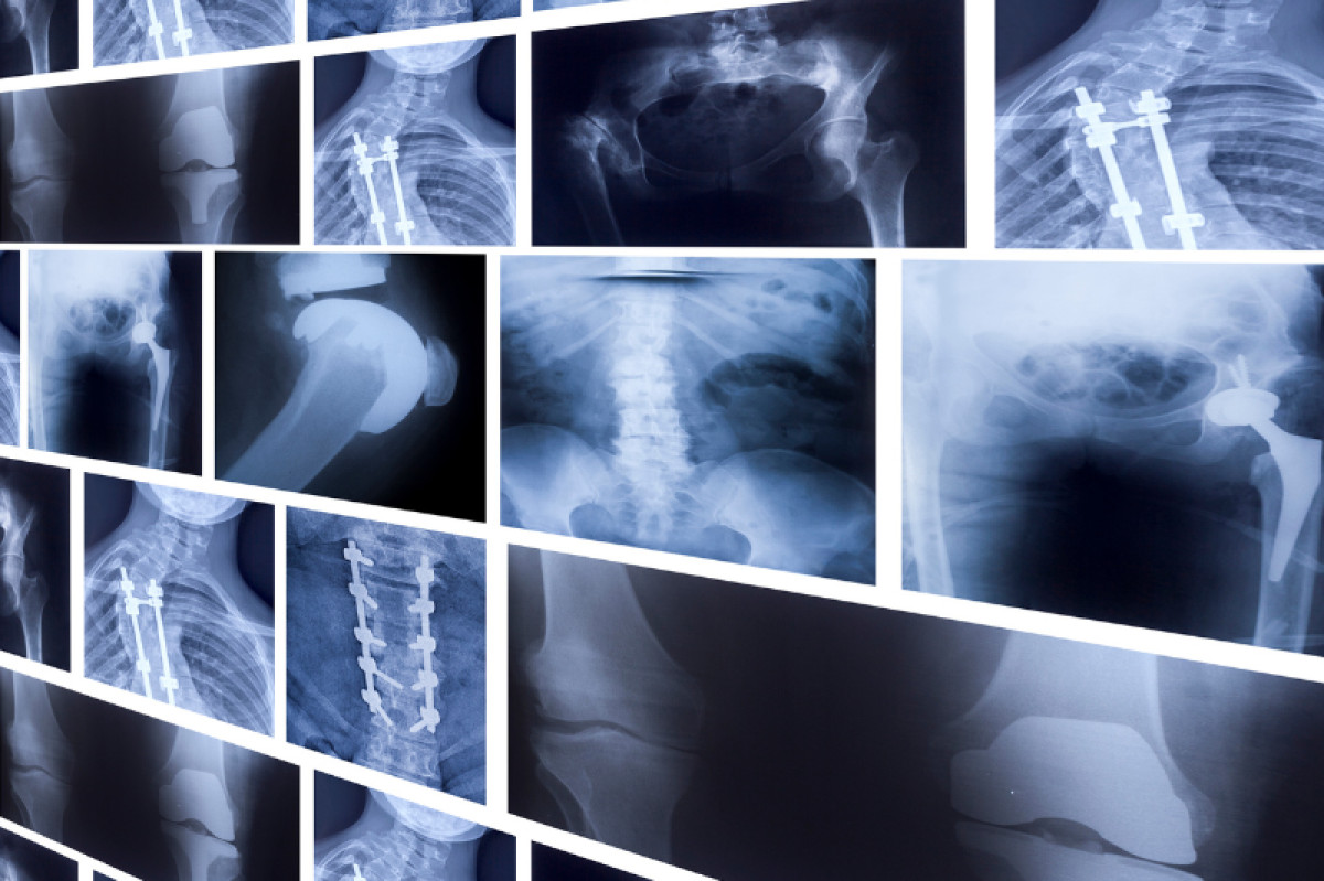 Kraj Vysočina s VŠPJ prověří využití umělé inteligence v radiologii