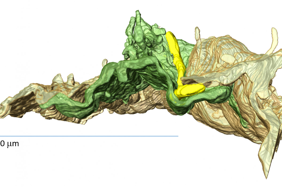 Borelie jsou mazané, do cév pronikají nenápadně