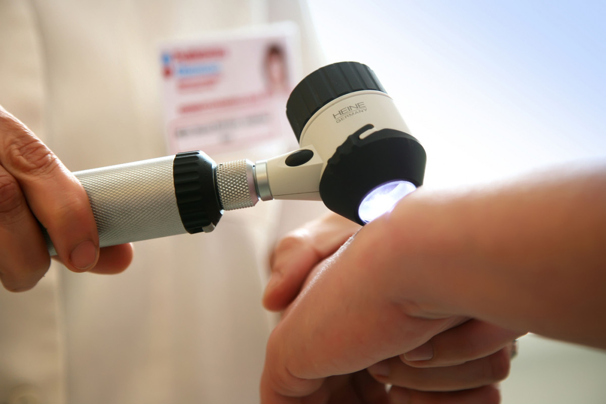 Kontrola znamének na konci léta je vhodnou prevencí