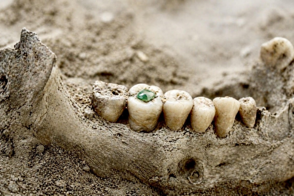 Mayská stomatologie šokuje. Zuby zdobili jadeitem